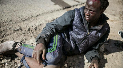 Un migrant blessé par la clôture qui sépare Melilla du territoire marocain, le 2 mars 2022. Crédit : picture alliance